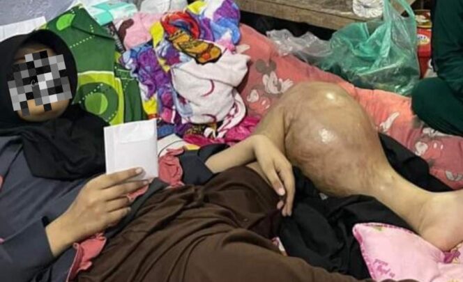 
					Mariatul butuh uluran tangan kita. (Foto: ilustrasi)