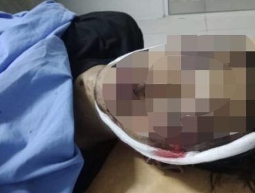 Terduga Pencuri Motor Tewas Usai Diamuk Massa di Gading Probolinggo