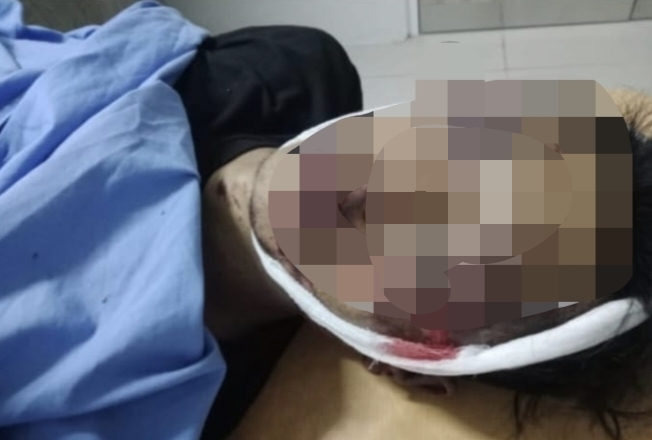 Terduga Pencuri Motor Tewas Usai Diamuk Massa di Gading Probolinggo